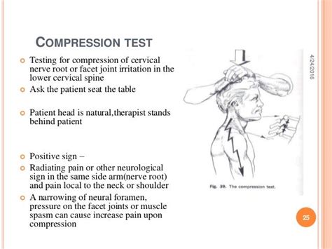 compression test positive|test for cervical nerve impingement.